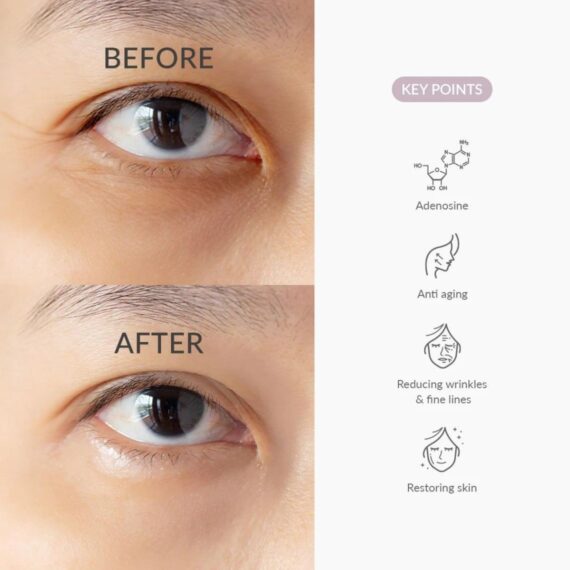 Before and after comparison of eye area with anti-aging benefits highlighted.