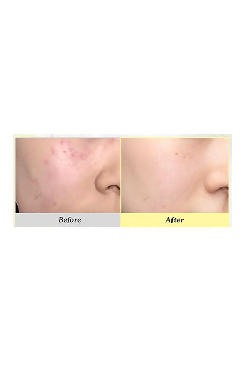 P.Calm Cato Cream – Soothing & Hydrating Korean Skincare Cream